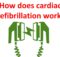 How does cardiac defibrillation work