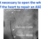 Is it necessary to open the whole of the heart to repair an ASD