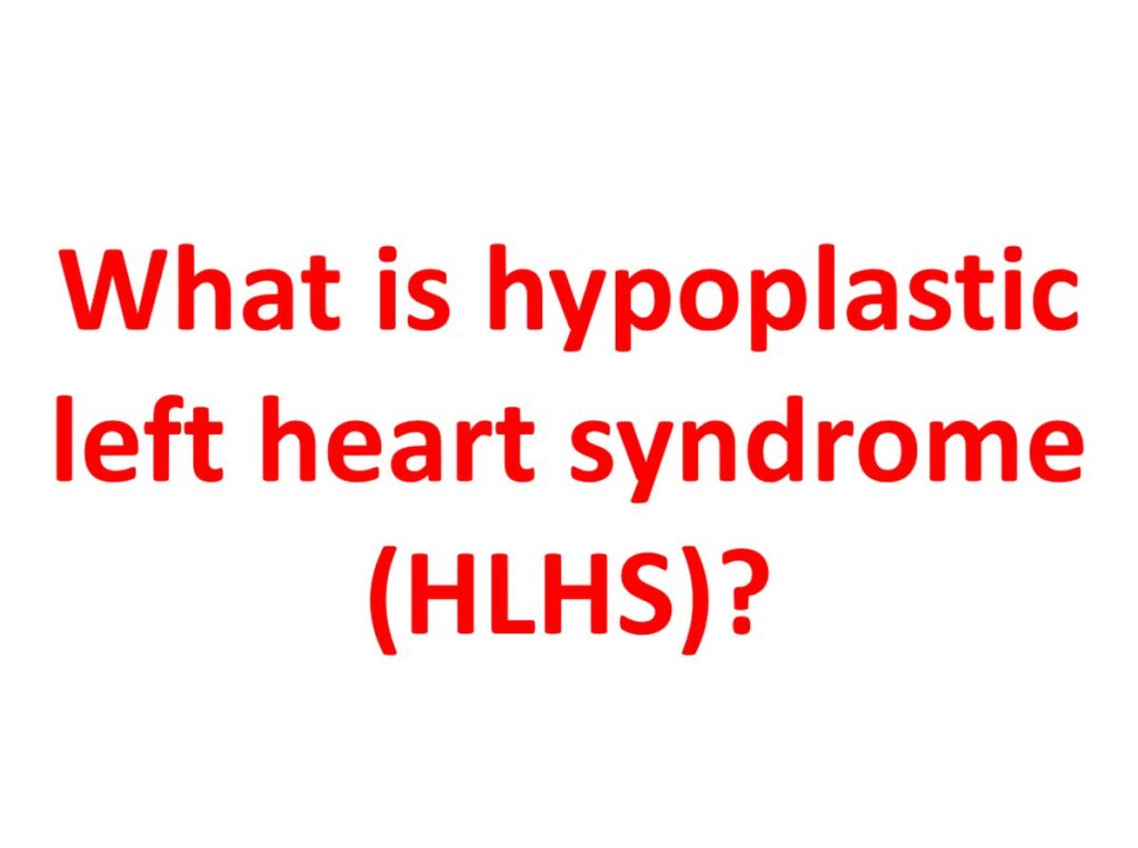 What is hypoplastic left heart syndrome (HLHS)?