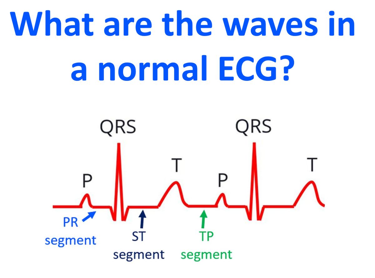 What are the waves in a normal ECG