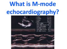 What is M-mode echocardiography
