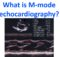 What is M-mode echocardiography