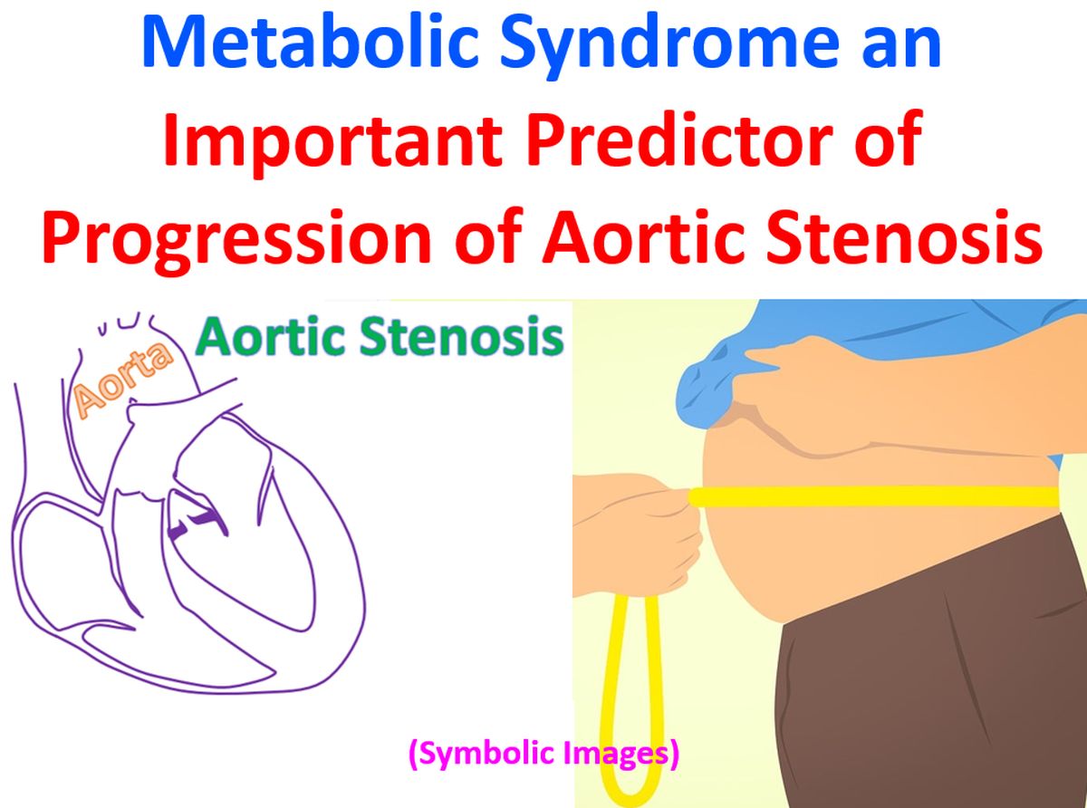 Metabolic Syndrome an Important Predictor of Progression of Aortic Stenosis