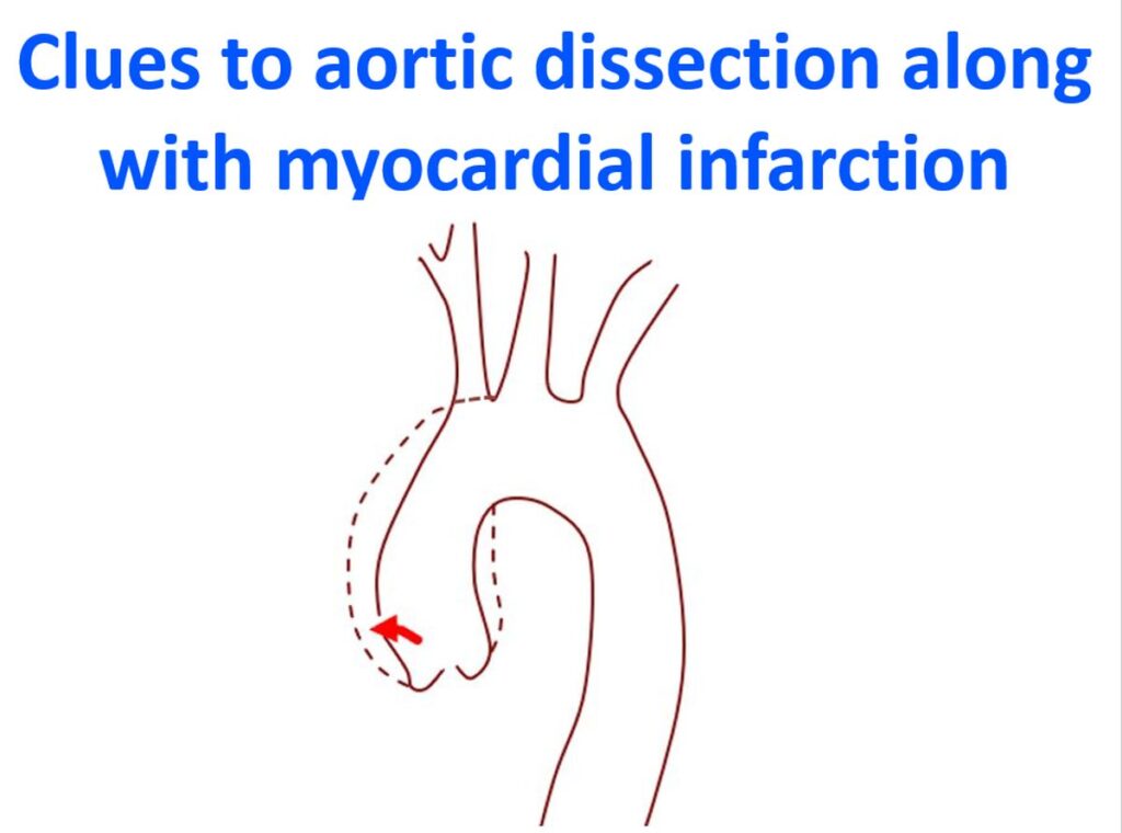 August 2013 – All About Cardiovascular System and Disorders