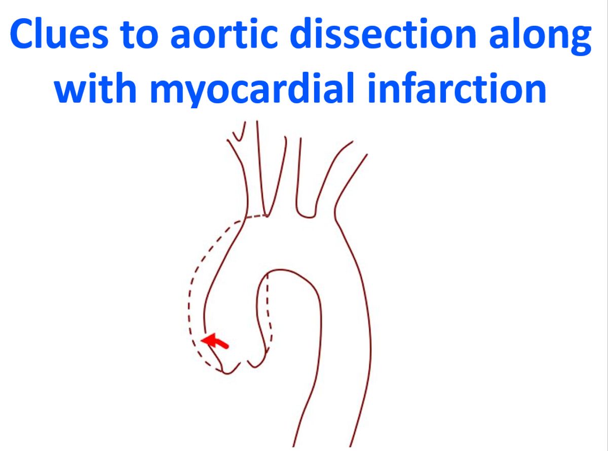 August 2013 – All About Cardiovascular System and Disorders