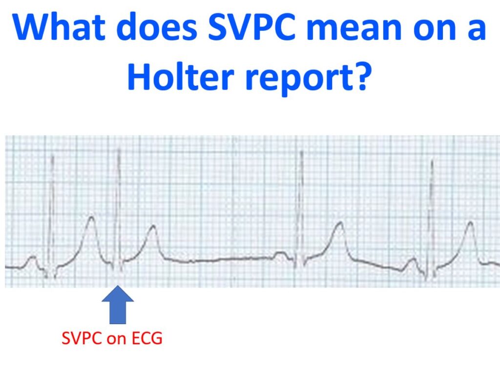 What does SVPC mean on a Holter report
