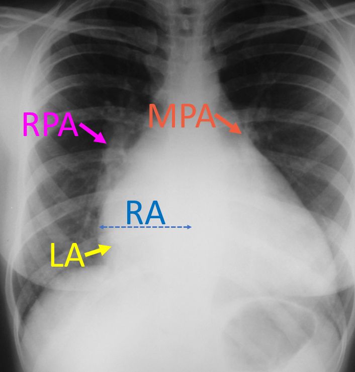 X-ray quiz 19 (Annotated)