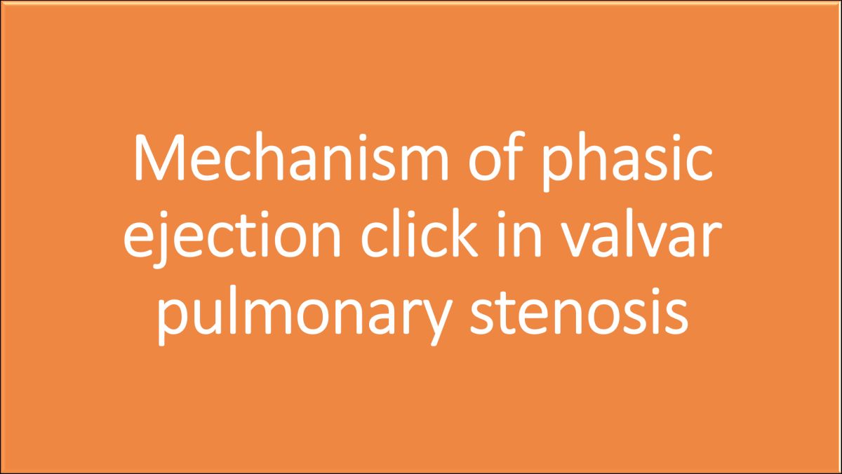 Mechanism of phasic ejection click in valvar pulmonary stenosis