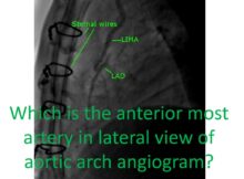 Which is the anterior most artery in lateral view of aortic arch angiogram