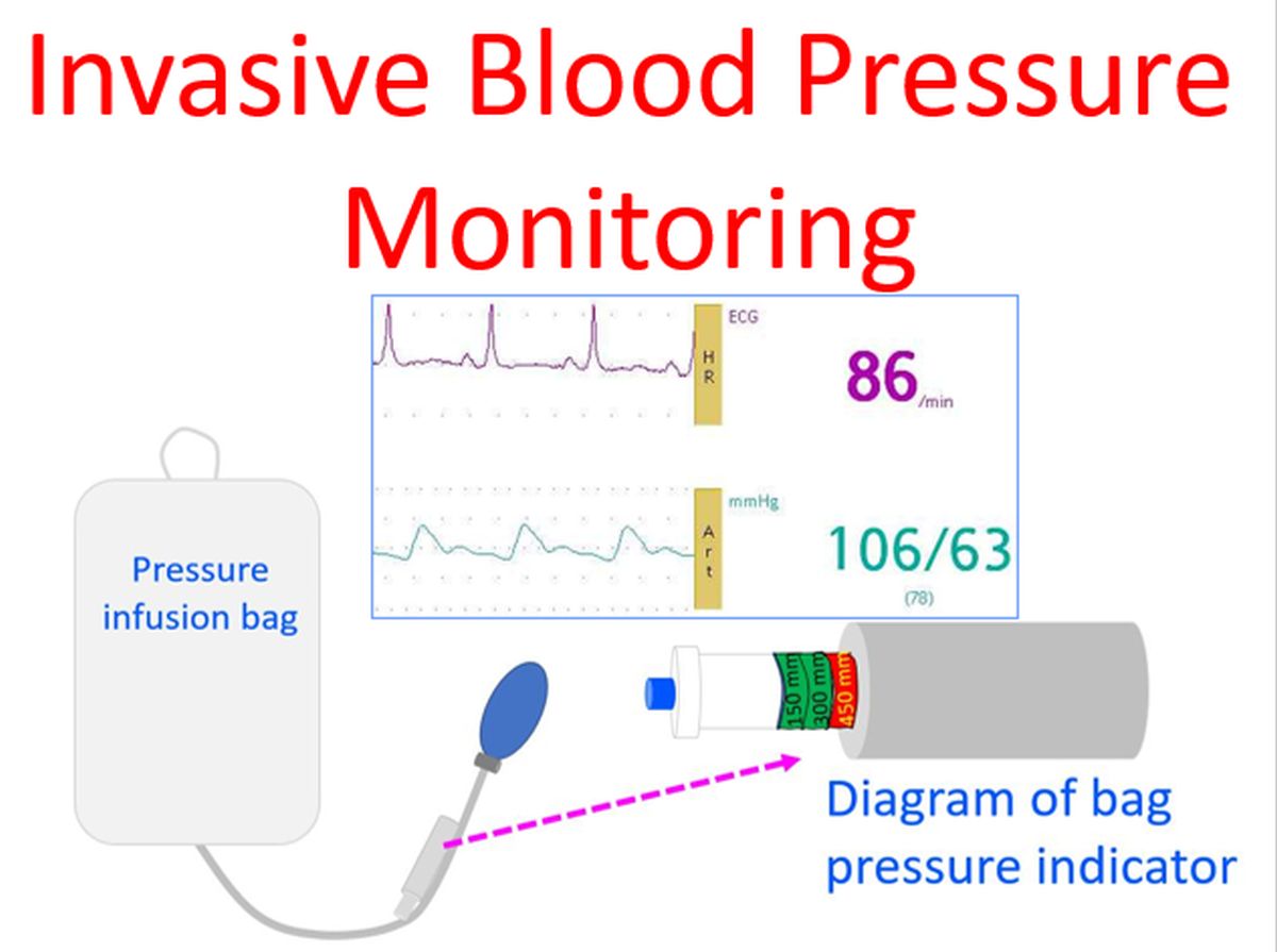 a. Non-invasive blood pressure measurement b. Invasive blood pressure