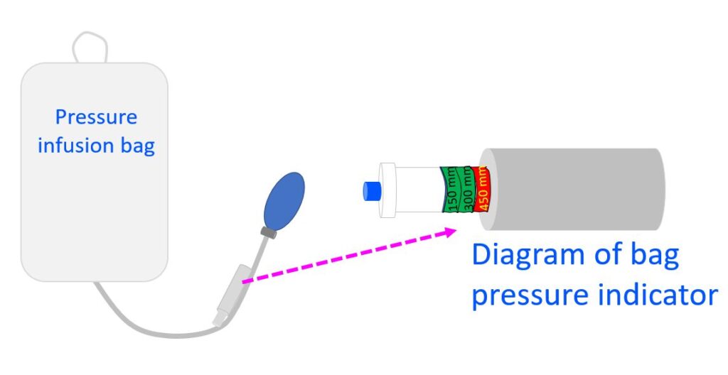 Pressure infusion bag and pressure indicator
