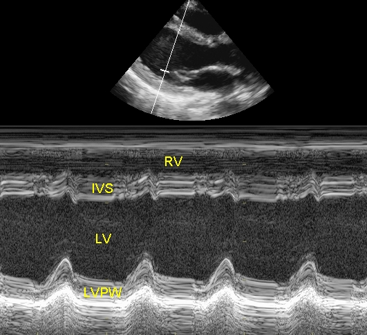 M-mode echocardiogram from parasternal location