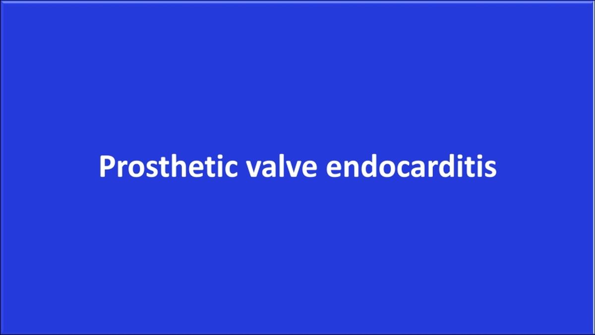 Prosthetic valve endocarditis - Early and late (beyond a year)