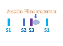 Austin Flint murmur
