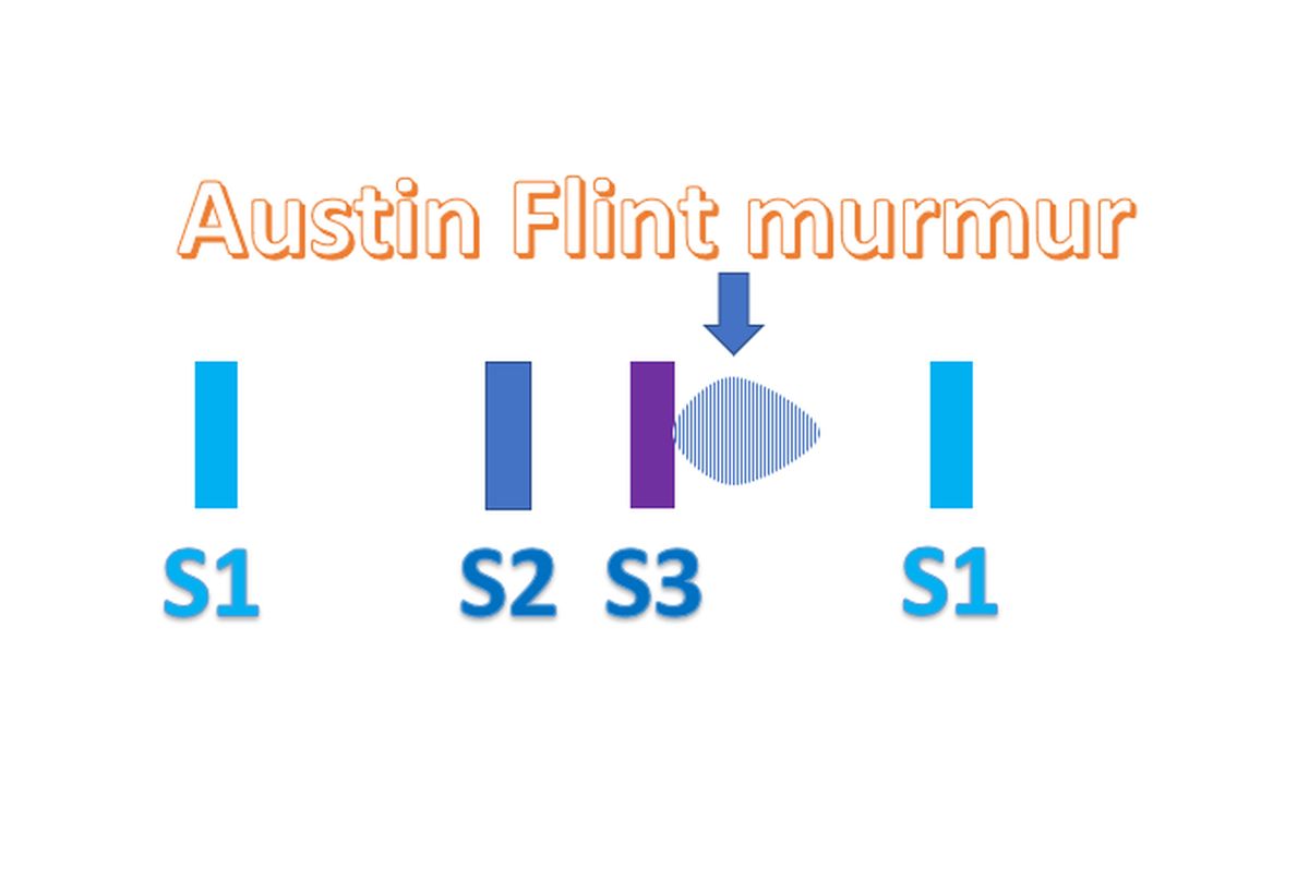 Austin Flint murmur