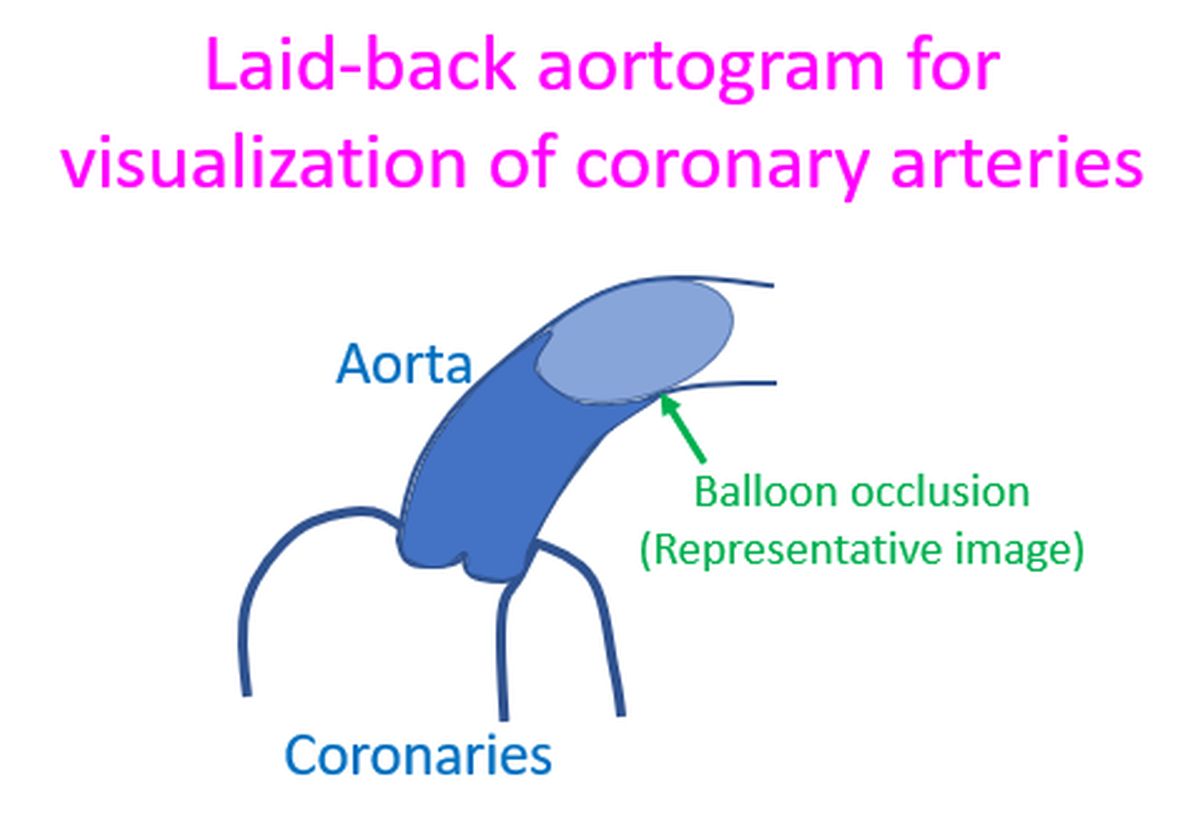 Laid-back aortogram for visualization of coronary arteries