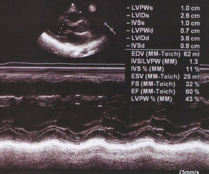 M-Mode echocardiogram at the chordal level