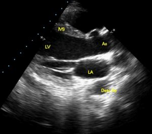 Echo1 – All About Cardiovascular System and Disorders