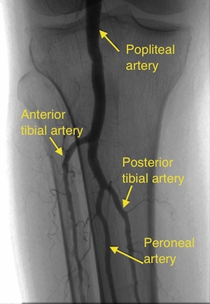 pag – All About Cardiovascular System and Disorders