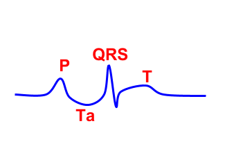 repolarization of the heart