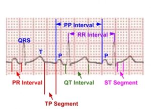 ECG Waves and Segments