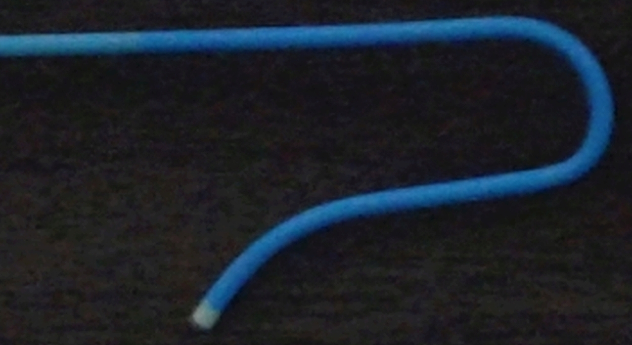 Simmons catheter (Sim catheter) has been used for cerebral angiography