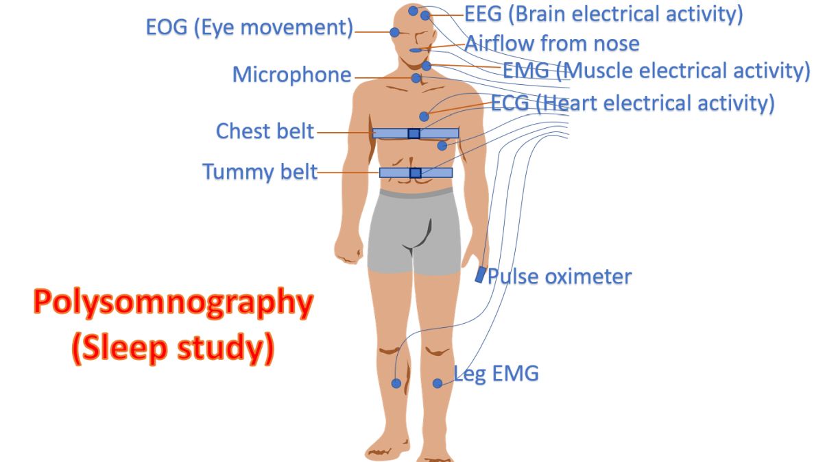 Polysomnography (Sleep study)