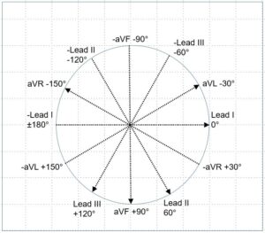 Electrical axis in ECG – All About Cardiovascular System and Disorders