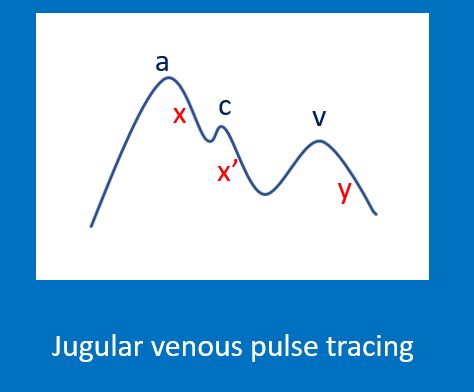 Jugular venous pulse tracing