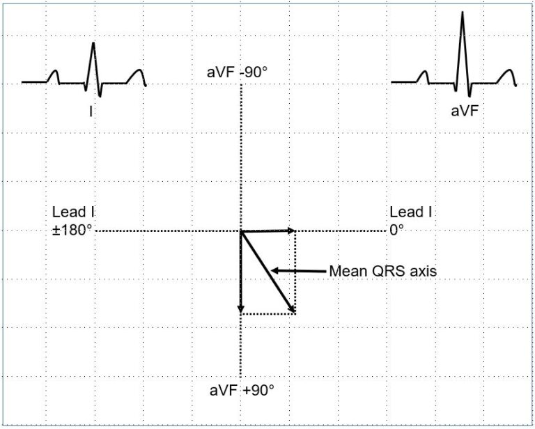 Electrical axis in ECG – All About Cardiovascular System and Disorders