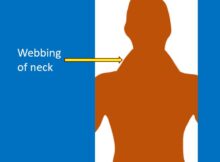 Webbing of neck