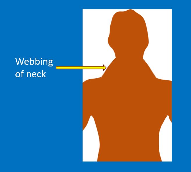 Webbing of neck