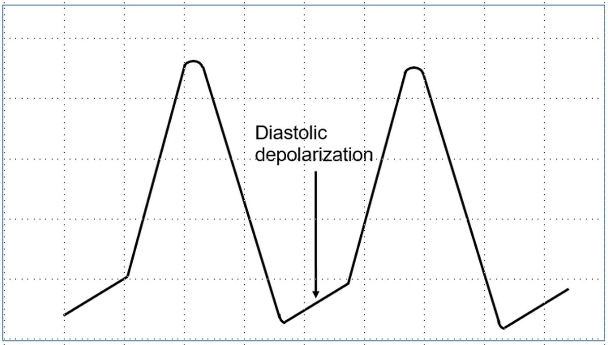 Action potential of pacemaker cells