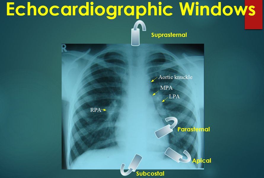 Echocardiographic windows