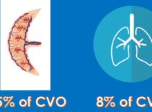 Fetal lung vs placenta