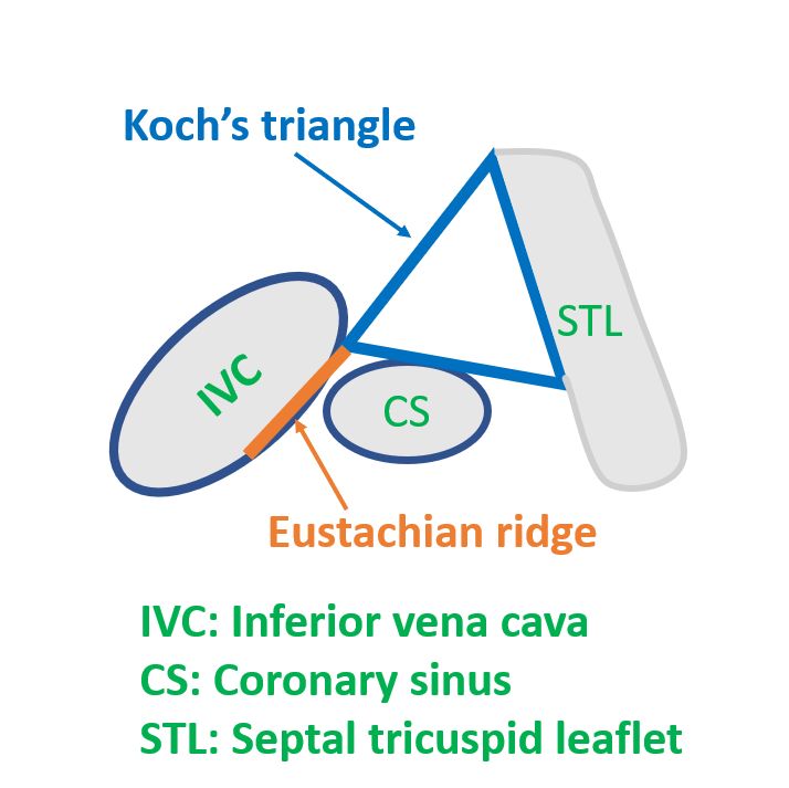 Diagram of Triangle of Koch