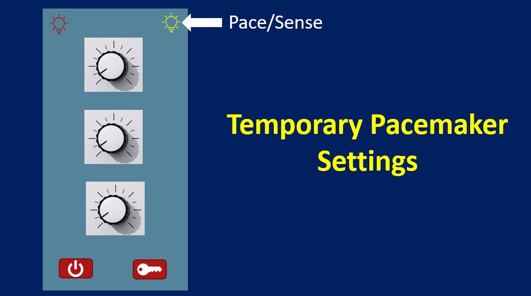 Pace-Sense Indicator