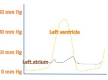 Hemodynamic quiz 2