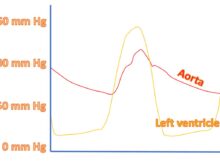 Hemodynamic quiz