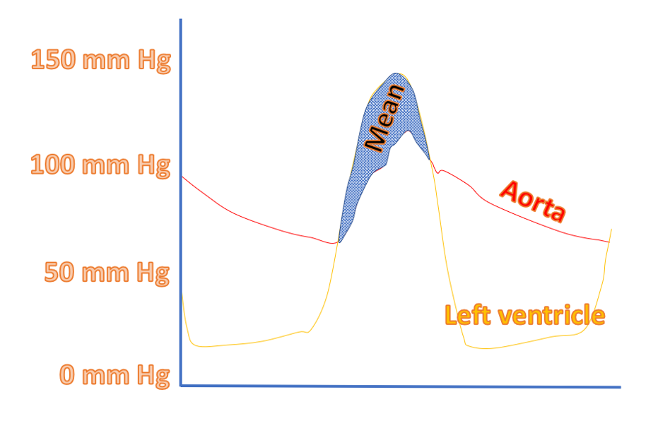 Measurement of mean pressure gradient in aortic stenosis