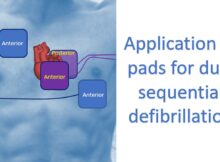 Application of pads for dual sequential defibrillation
