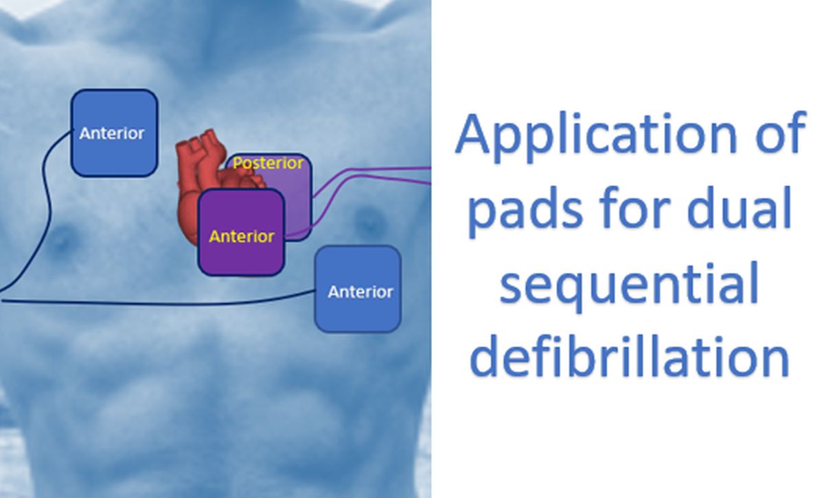 Application of pads for dual sequential defibrillation