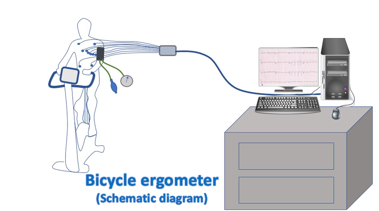 Bicycle ergometer (schematic diagram)