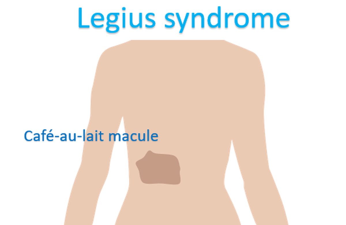 Legius Syndrome - an overview