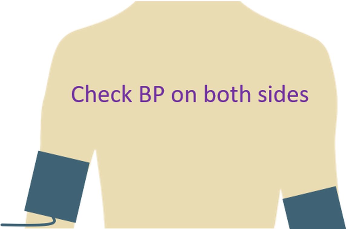 Check BP on both sides