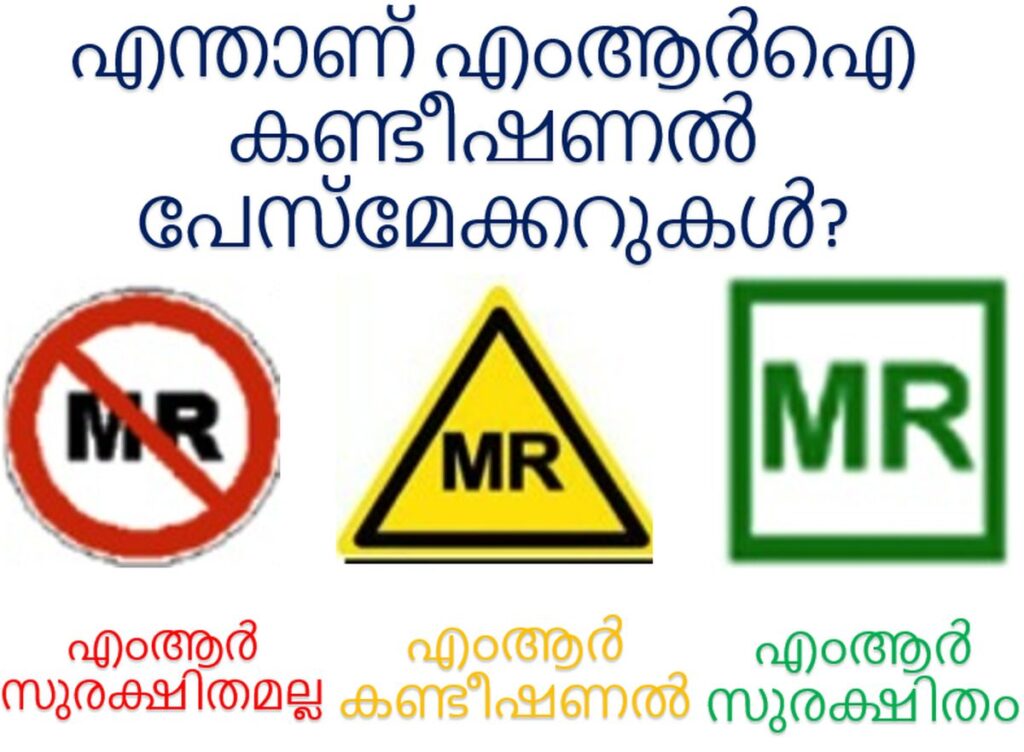 എന്താണ് എംആർഐ കണ്ടീഷണൽ പേസ്മേക്കറുകൾ