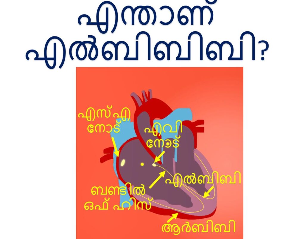 എന്താണ് എൽബിബിബി