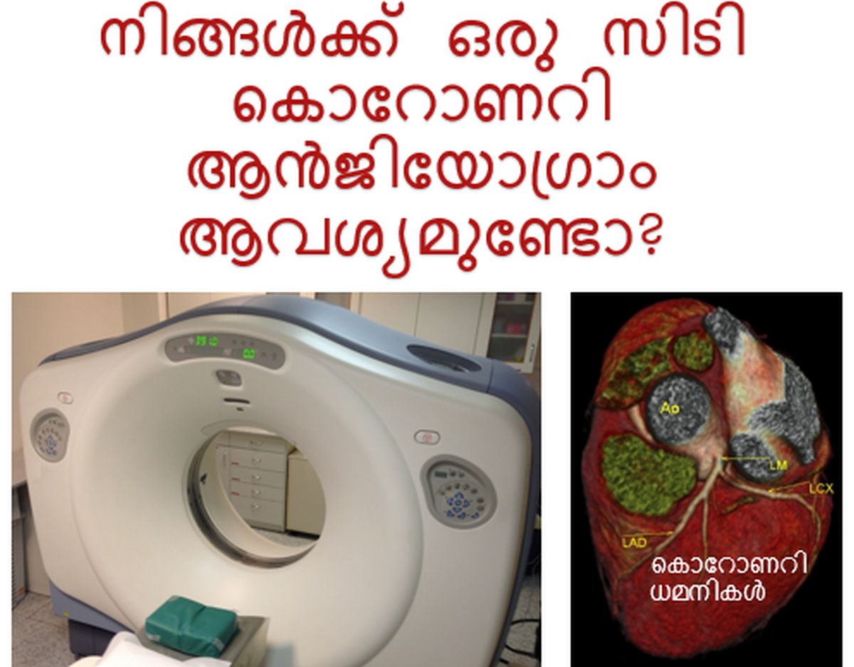 നിങ്ങൾക്ക് ഒരു സിടി കൊറോണറി ആൻജിയോഗ്രാം ആവശ്യമുണ്ടോ