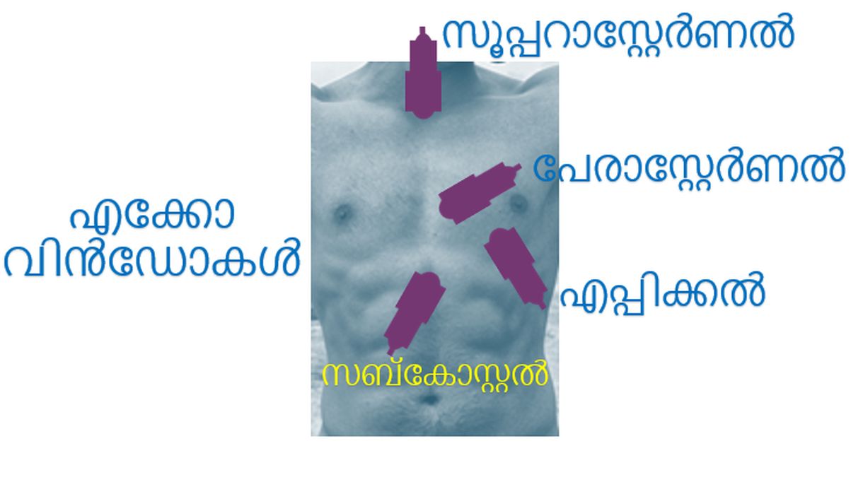 എക്കോ വിൻഡോകൾ