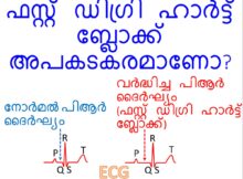 ഫസ്റ്റ് ഡിഗ്രി ഹാർട്ട് ബ്ലോക്ക് അപകടകരമാണോ